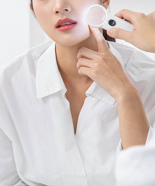피부 진단